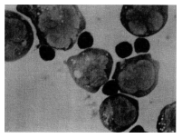 Figure 6: Natural killer (NK) effector-tumour targets conjugate formation.